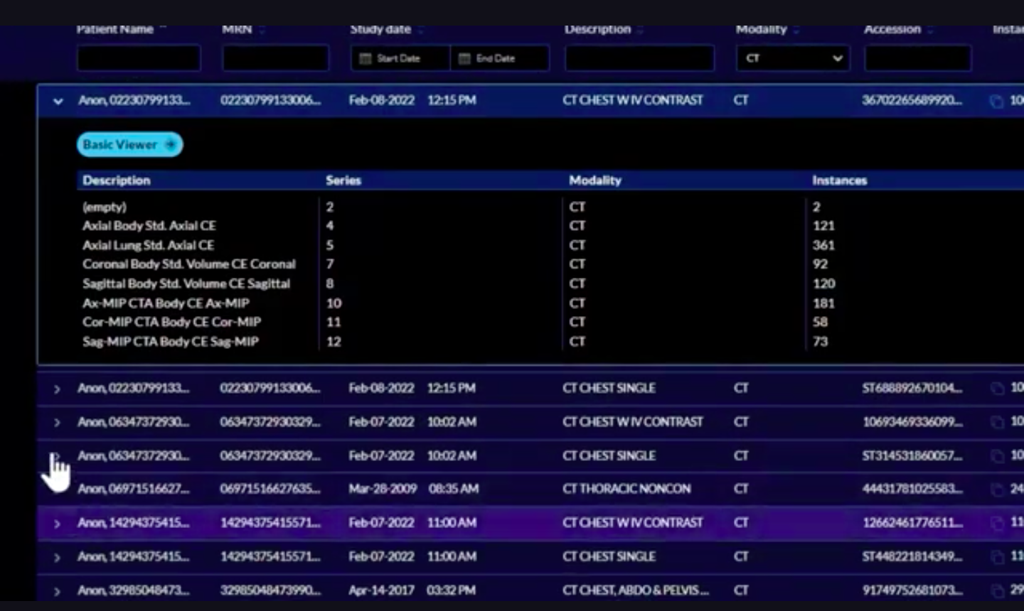ENDEX interface
